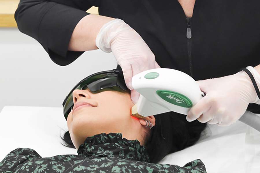 woman receiving a laser facial