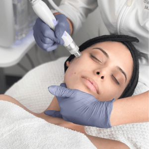woman receiving hydradermabrasion facial