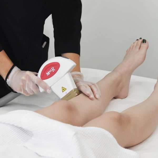 Laser hair removal hand piece device being held against a shin.