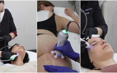 Radiofrequency Skin Tightening: How can it treat my cellulite, jawline, and face?