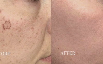 How A Skin Specialist in Winnipeg Can Transform Your Skin Care Routine