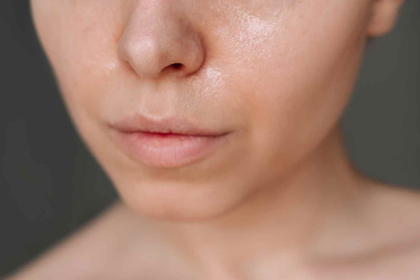 Shiny skin around the nose and cheeks showing excess sebum production, supporting the topic How Do I Stop My Skin From Being So Oily?