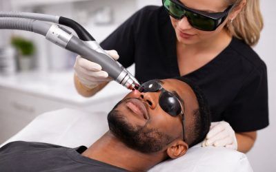 Explained: Laser Treatments in Winnipeg for Acne Scars, Pigmentation, and Fine Lines