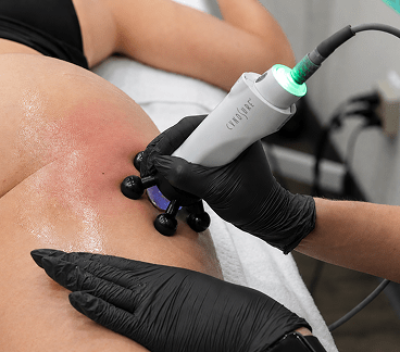 Body contouring and skin tightening services in Winnipeg Manitoba