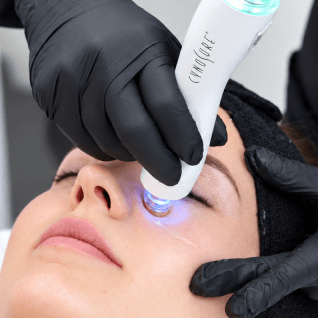 Dermaplaning Exfoliating Treatment at Total Wrapture Medi Spa Winnipeg