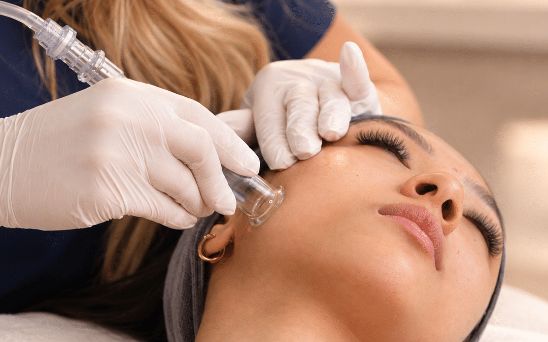 Hydrafacial treatment